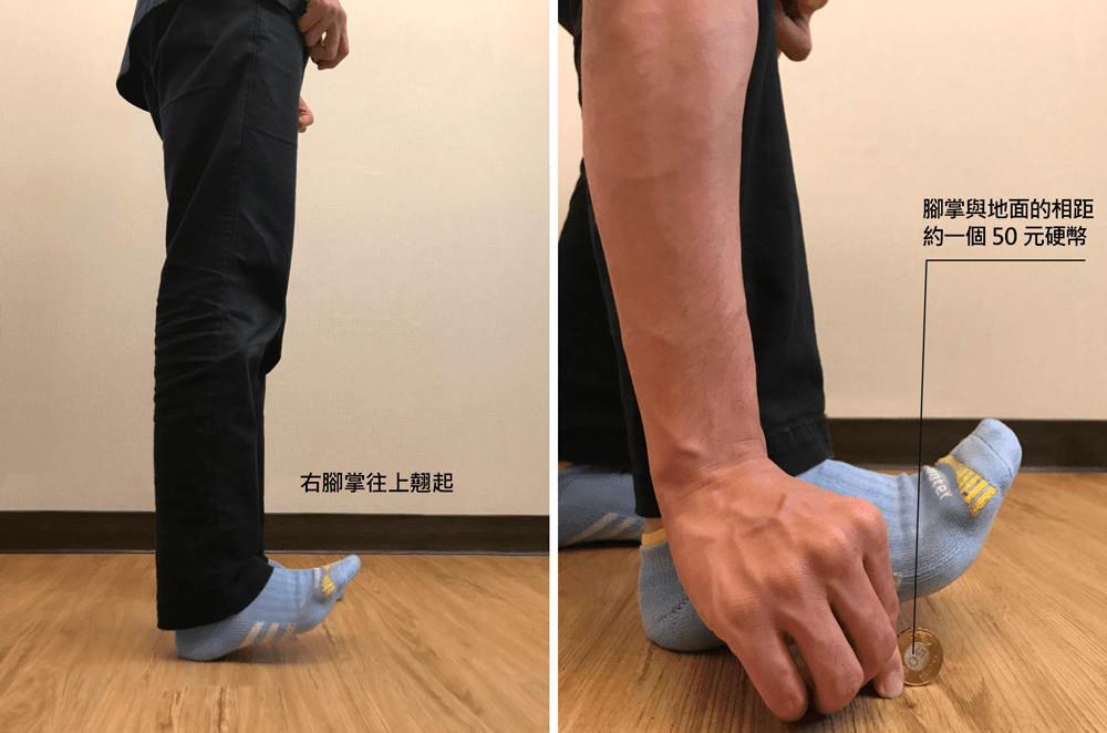 2 招自我評估找到膝蓋痛的原因 - e5b3bbe98291e59c96e78987_3.png